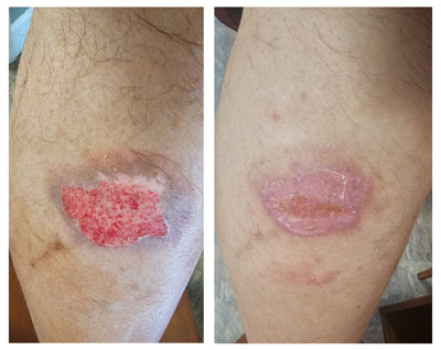 Michael R. - Apr 2025