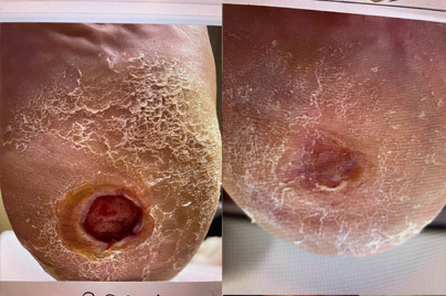 Betty W. - March 2025