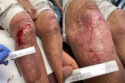 Margaret B. - May 2025